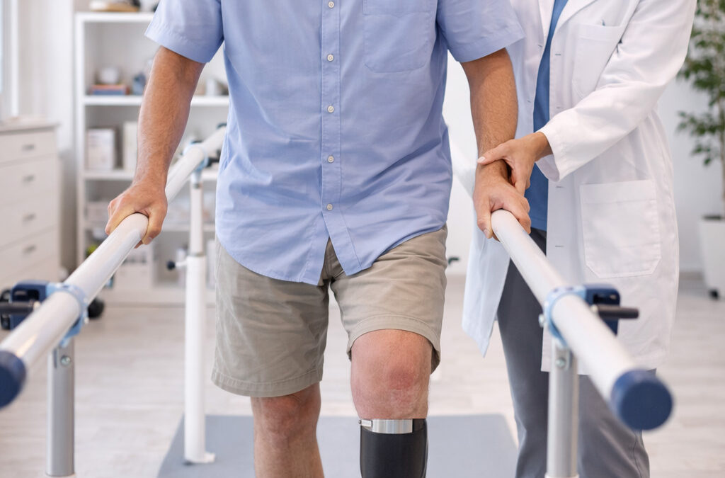Prótesis: primeras dudas tras una amputación — fases, tiempos y cómo prepararse para ello.